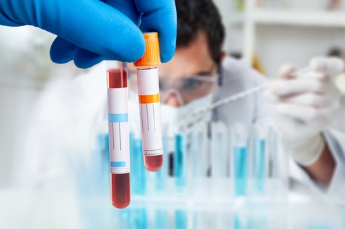 Certified Phlebotomist DUI Lawyer in Indiana, DUI blood test.